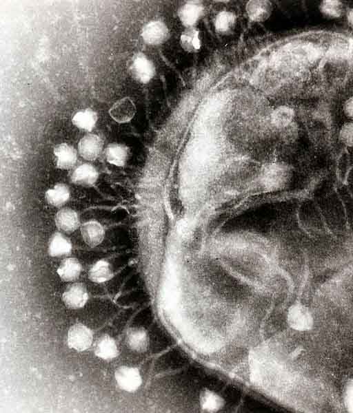 Bacteriophage Viruses Attacking a Bacterium