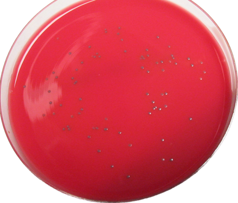 Listeria monocytogenes grown on Biorad RAPID'L.Mono Agar