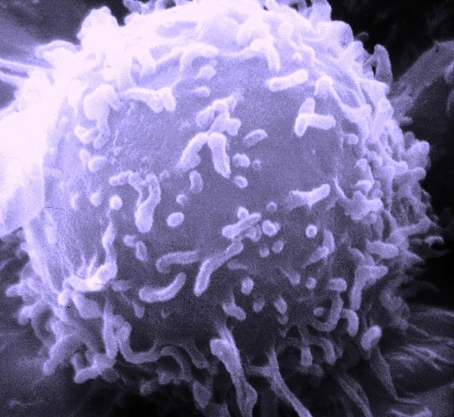 Single human lymphocytes viewed with scanning electron microscope