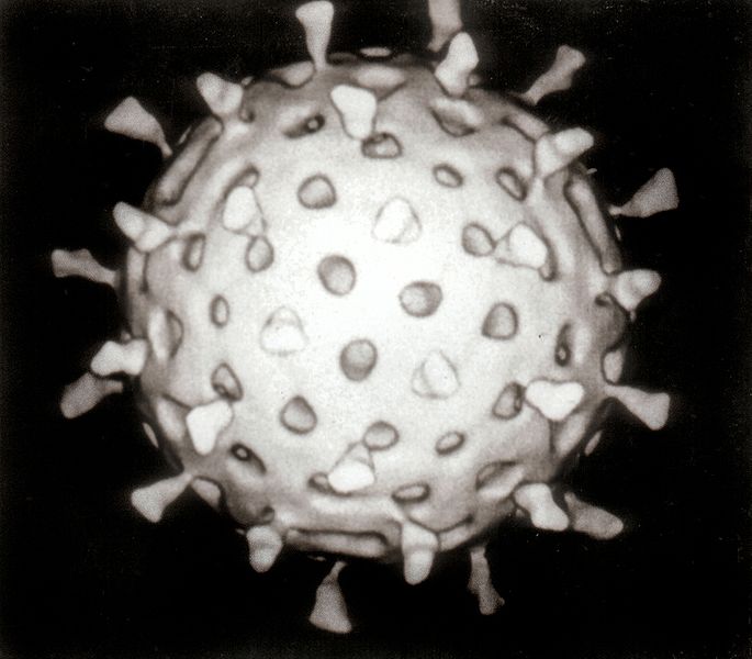 Computer assisted reconstruction of a rotavirus particle