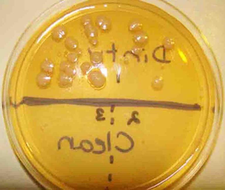 Plate of TSY Agar With Bacterial Samples from Dishes Before And After Dishwasher
