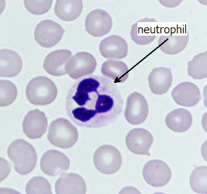 Human neutrophil (white blood cell) surrounded by erythrocyte (red blood cells).