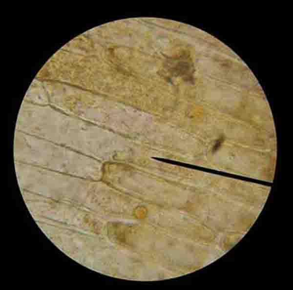 Onion bulb skin cells 400xTM.