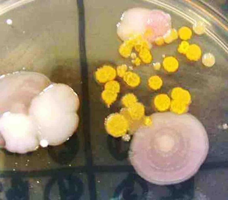 Gram-negative bacterial colonies growing on MacConkey's agar. A pink colony indicates that the bacteria eat the sugar lactose.
