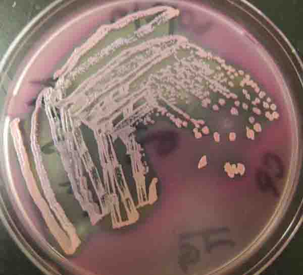 MacConkey's Agar Growing Gram-, Lactose Fermenting Bacteria