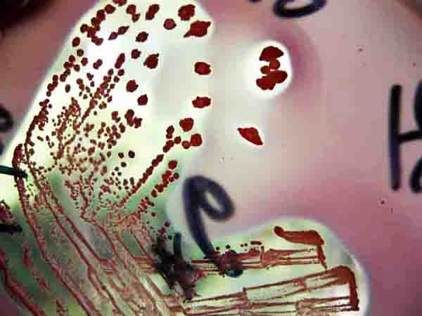 E. coli on MacKonkey's Agar That Has Dried Up