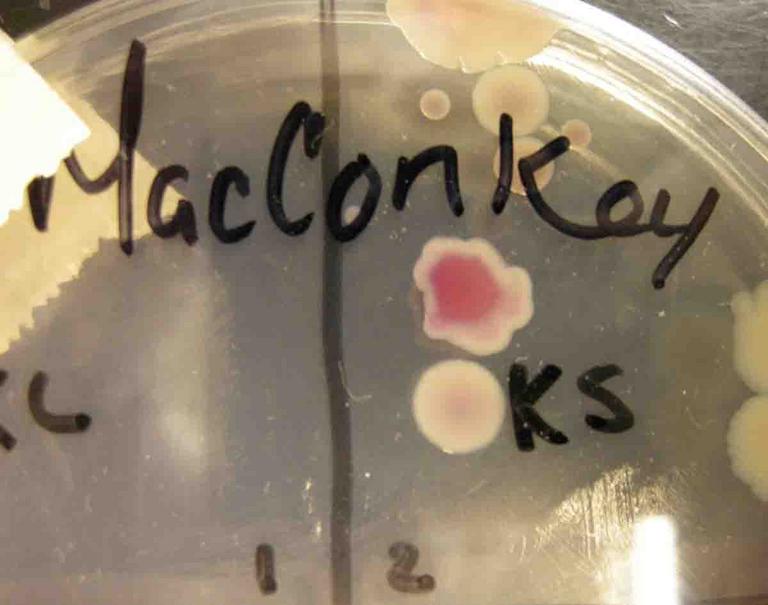 MacConkey's Agar showing lactose positive pink colony above a lactose negative colorless colony.