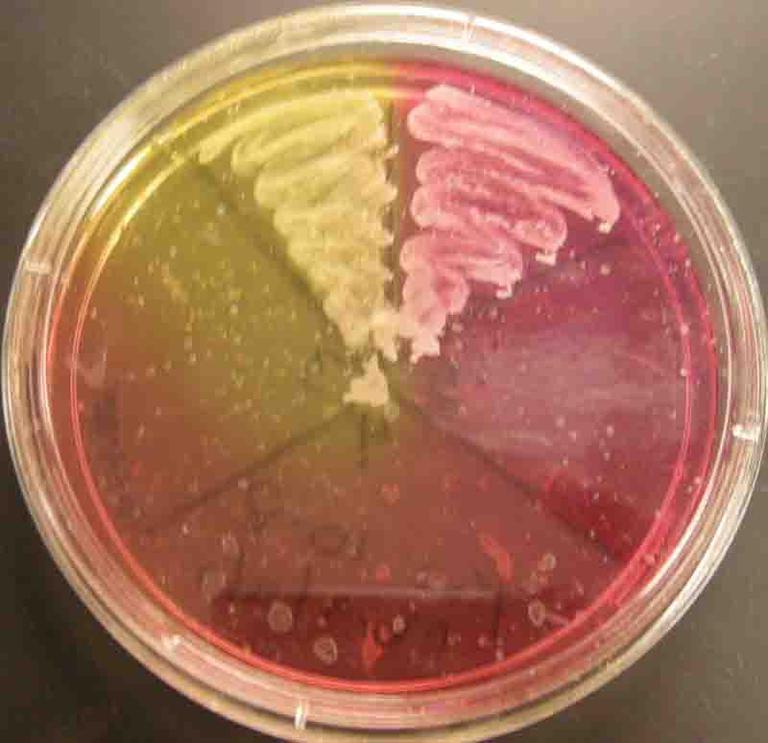 Mannitol Salt Agar control plate. Staph aureus (top left) Staph epi (top right). Other sections inoculated with non-halophilic bacteria or sterile loop (negative control).