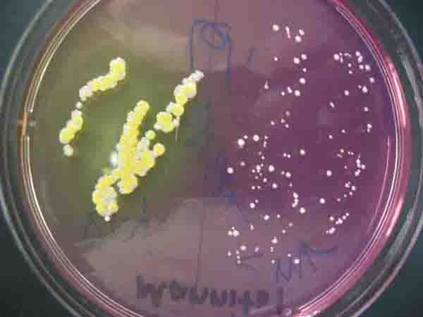 Bacterial Growth on Mannitol Salt Agar. Weak Mannitol Fermenter on Left