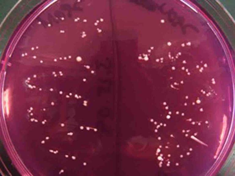 Tiny punctiform bacterial colonies characteristic of Staphylococcus