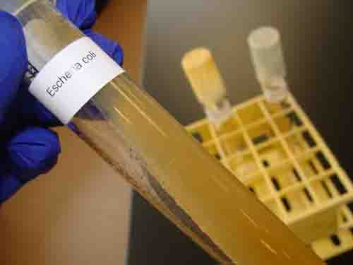 E. coli growing in a slant tube of TSY.