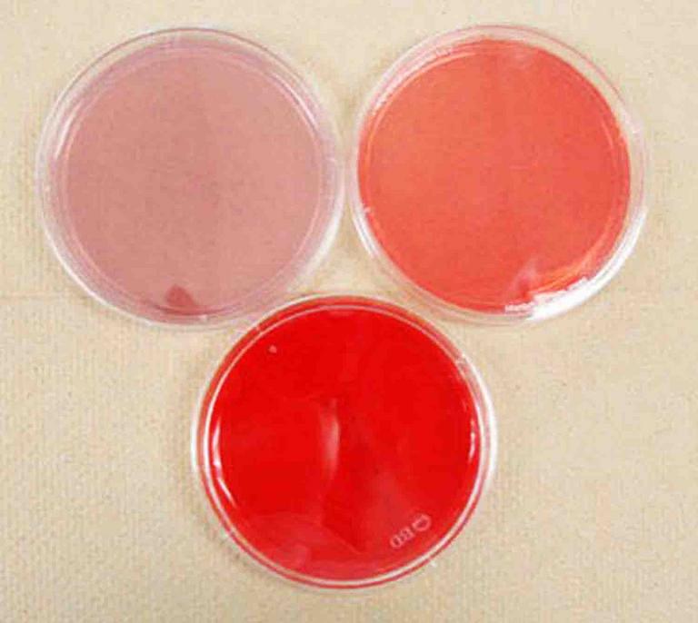 Sterile Specialized Bacterial Growth Media. Clockwise from top left MacConkey's, Mannitol Salt and Blood Agar