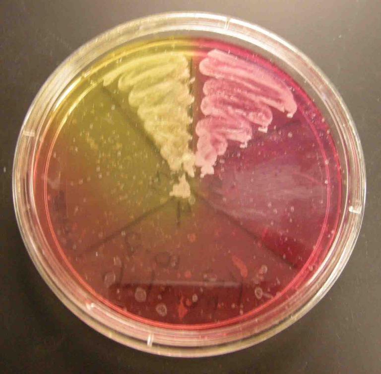 Mannitol Salt Agar inoculated with the following control samples (clockwise from top left): Staph aureus, Staph epi, sterile loop, Salmonella, E. coli.