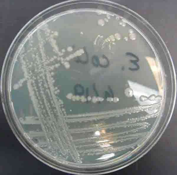E. coli bacterial colonies grown on TSY agar.