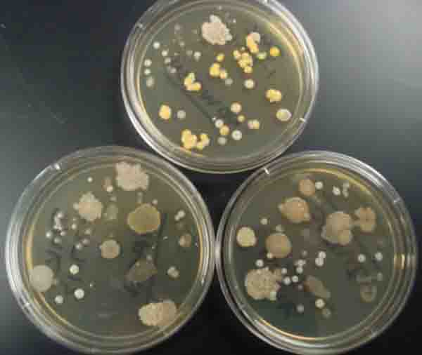  Touch Plates: TSY media plates touched by fingertips then incubated resulting in many bacterial colonies.