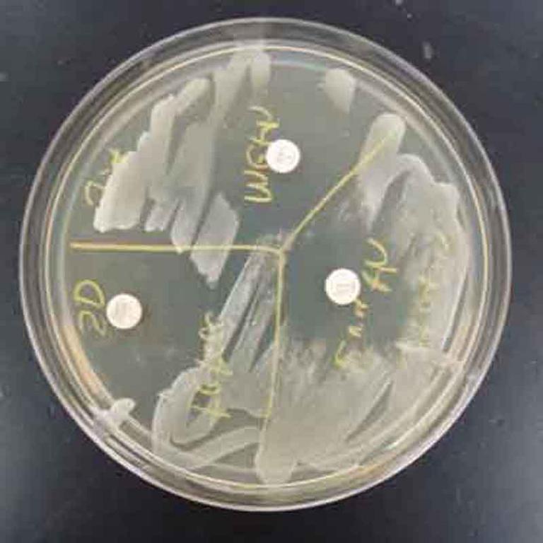 TSY agar inoculated with Staphylococcus. Three antibiotic sensitivity disks appear on this medium: penicillin, sulfa, and ciprofloxacin (clockwise from top). Note the "zone of inhibition" around each antibiotic disk. The larger the zone of bacterial inhibition, the more effective the antibiotic is against the bacteria.