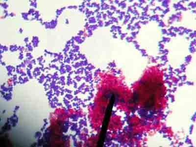 staphylococcus epidermidis endospore stain