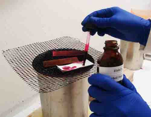 Applying Carbol Fuchsin to Bacterial Smear Over Water Bath