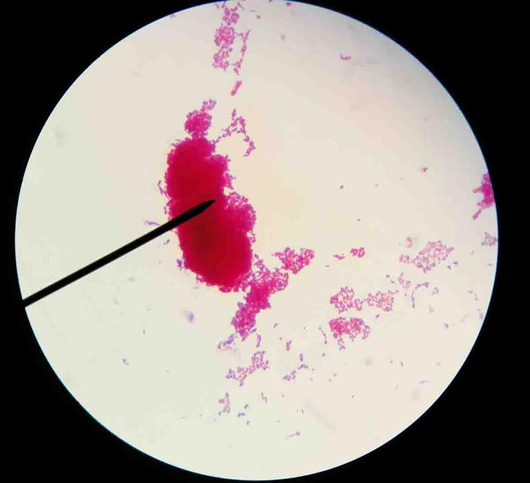 Acid-fast bacteria Mycobacterium smegmatis viewed under oil immersion @ 1000xTM