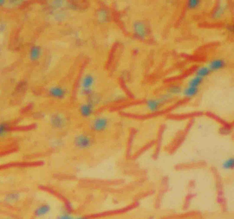 Endospore stained bacterial smear of Bacillus subtilis viewed under oil immersion @1000xTM. Pink rods are vegetative bacillus-shaped cells and smaller blue-green oval objects are endospores.
