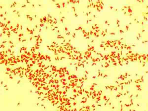 Gram Negative Bacteria, E. coli @ 1000xTM