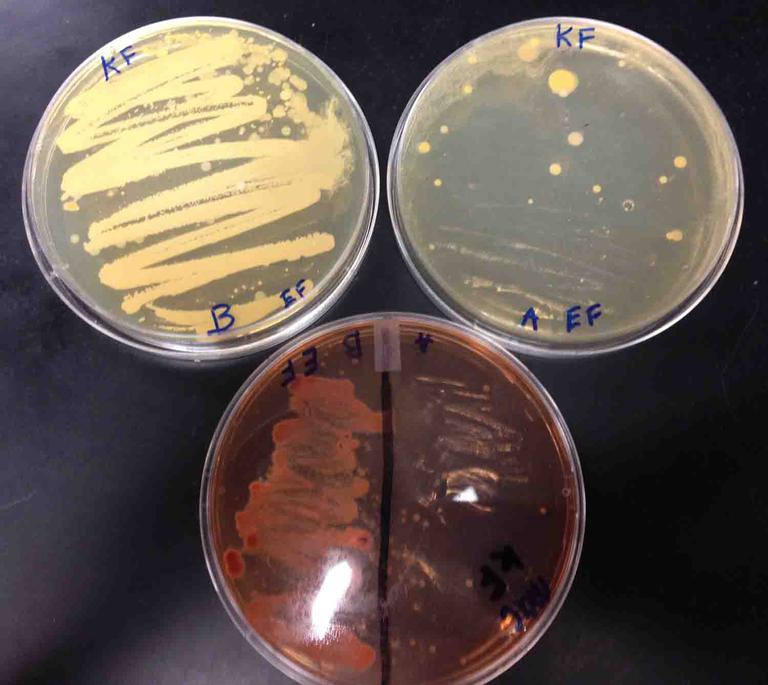 Bacterial Growth Media Showing Before and After Results of Floor Cleaning With the Shark Light and Easy Steam Mop