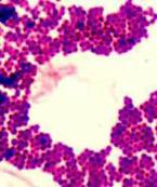 Gram Stain of Prokaryote Bacteria Staphylococcus epidermidis