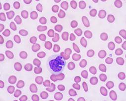 Monocyte Agranulocyte White Blood Cell