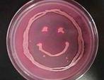 MacConkey's Agar Growing E. coli