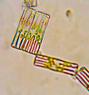 Tabellaria diatom algae @400xTM