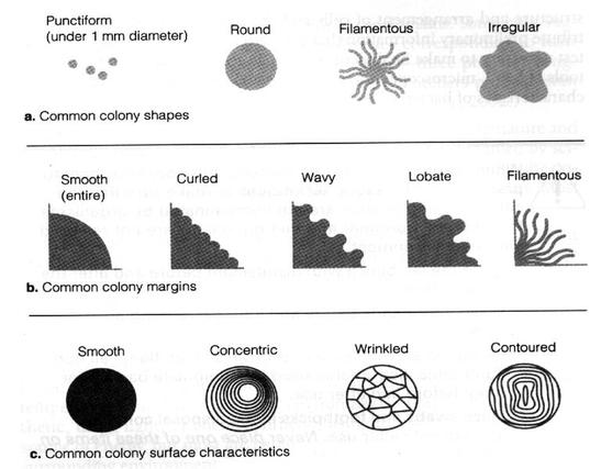 Bacterial Colony Morphology Diagram