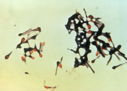 Clostridium tetani bacteria from the Public Health Image Library, image #6372