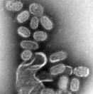 Influenza Virus Magnified 100,000x