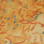 Endospore stained Bacillus subtilis bacteria viewed @ 1000xTM. 