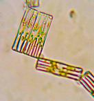 Tabellaria diatom algae @400xTM