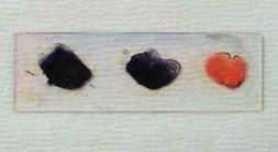 Gram stained slide, showing + & - bacterial controls on left and right circles of slide and unknown bacteria in center.