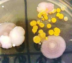 Example of Colony Morphology of Bacteria Grown onMacConkey's