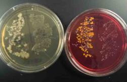 Nasal Samples of Bacteria Plated on TSY and on Mannitol Salt Agar