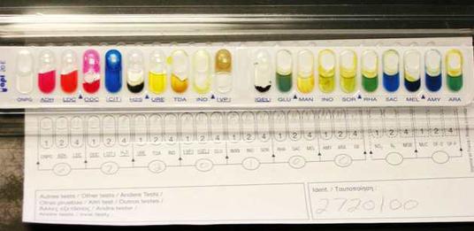 API-20E Strip for Identifying Gram-negative Bacteria