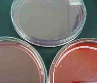 MacConkey's Agar, Blood Agar & Mannitol Salt Agar Bacterial Growth Media (clockwise from top)