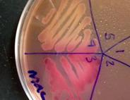 MacConkey's Agar with Lac- Salmonella on top and Lac+ E. coli on bottom