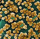 Staphylococcus aureus by Janice Haney Carr