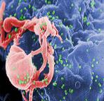 HIV Viuses Budding OFF Cultured Lymphocyte