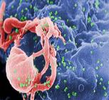 HIV Viruses Budding from Cultures Lymphocytes