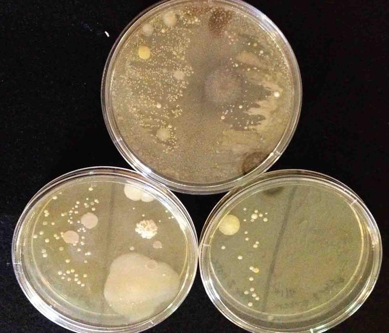 Three plates of TSY bacterial growth agar with samples taken from an iPhone. 1. Top plate is "before cleaning" sample, with front/screen sample on right side of plate and back/case sample on left; 2. Lower left plate is "after first cleaning" with one disinfecting wipe, screen sample on right side of plate, case sample on left.; 3. Lower right plate is the "after second cleaning" with another disinfectant wipe, screen sample on right, case sample on left.