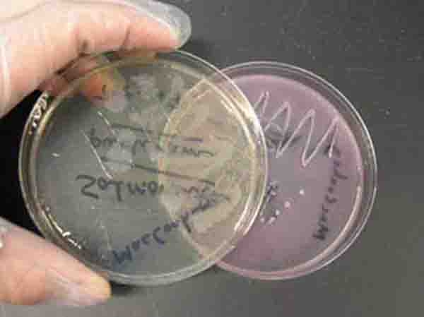 MacConkey's Agar: Plate on left it growing Gram-nagative lactose negarive bacterial. Plate on right is growing Gram-negative, lactose positive bacteria.