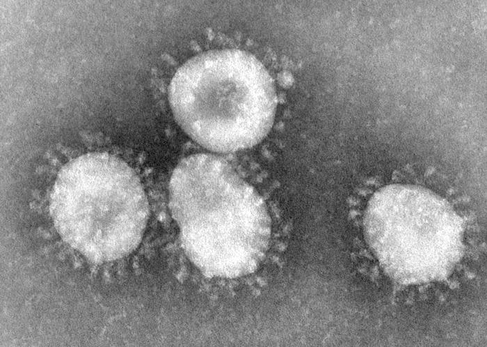 Coronaviruses are one type of virus known to cause the common cold. They have a halo, or crown-like (corona) appearance when viewed under an electron microscope.