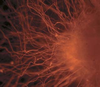 Neurons Derived from Embryonic Stem Cells