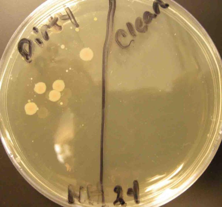 TSY Media Growing Bacterial Samples from a Dirty and a Clean Dishwash
