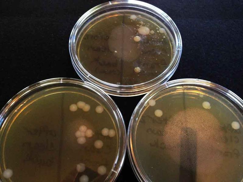Three plates of TSY bacterial growth agar with samples taken from an iPhone. 1. Top plate is "before cleaning" sample, with front/screen sample on right side of plate and back/case sample on left.; 2. Lower left plate is "after first cleaning" with one disinfecting wipe, screen sample on right side of plate, case sample on left. 3. Lower right plate is the "after second cleaning" with another disinfectant wipe, screen sample on right, case sample on left.
